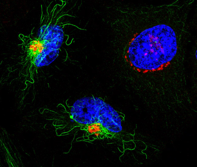 Dottorato in Scienze Biomolecolari: aperta una posizione di ricerca sul ruolo del complesso di Golgi nello sviluppo dei tumori